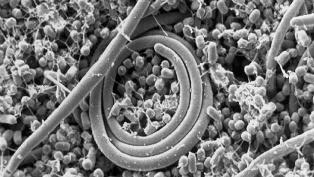 Salmonella enteritidis thumb